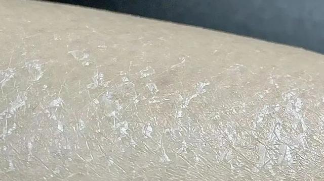 身体乳怎么用，不涂，皮肤有多大区别