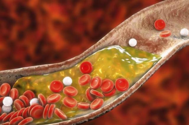 乌鸡汤是发物吗，发物最厉害的十种食物（这些“发物”建议少碰）