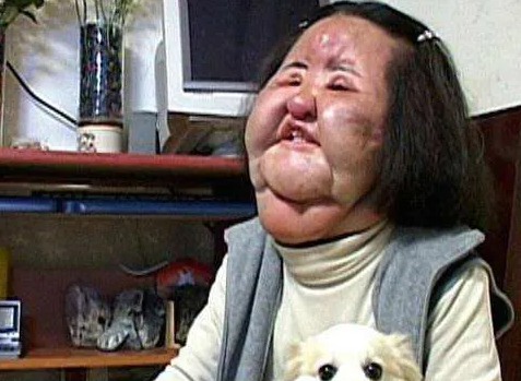 韩国女明星整容上瘾，自己向脸部注射食用油，9年无法闭眼睡觉