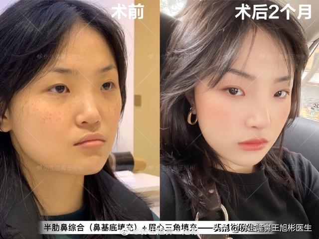 高级脸是什么意思，6种脸型不显老（“月亮脸”逆袭“高级脸”的不二法则是）