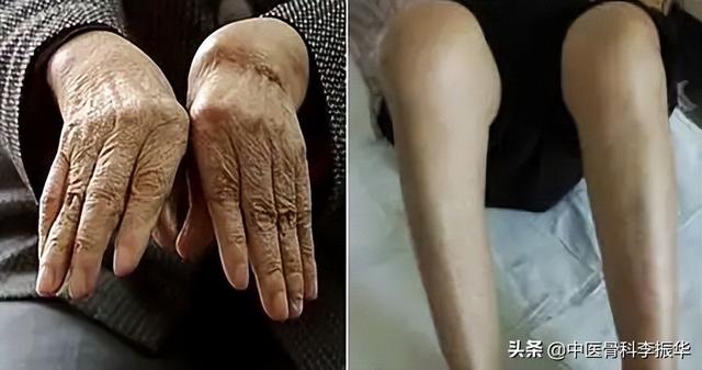 伸筋草的作用，伸筋草能治什么病（治关节痹痛）