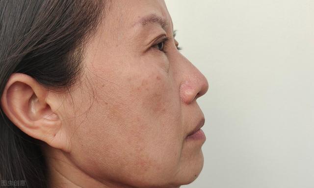 美白去黄有效方法，偷偷美白新思路