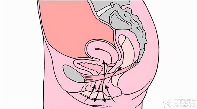 凯格尔运动怎么做，怎样进行凯格尔运动（神奇的凯格尔运动怎么做）