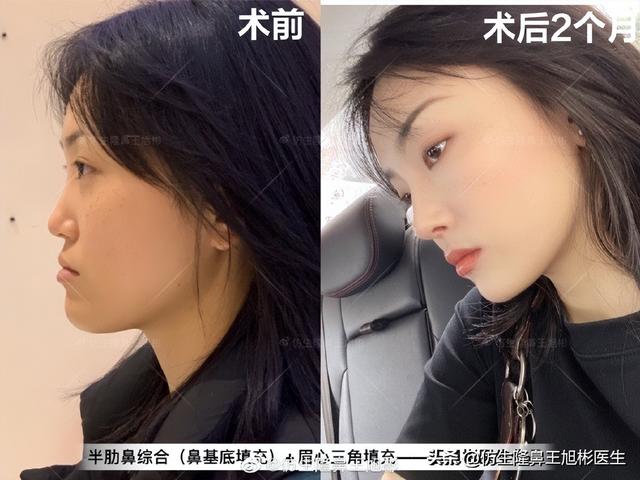 高级脸是什么意思，6种脸型不显老（“月亮脸”逆袭“高级脸”的不二法则是）