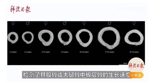 生育永久改变女性骨骼，生育永久改变女性骨骼状态（女人生孩子就像鬼门关走一遭）