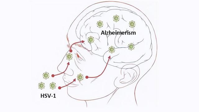 嘴巴上火起泡怎么办，嘴巴起泡怎么办（你以为的“上火”）