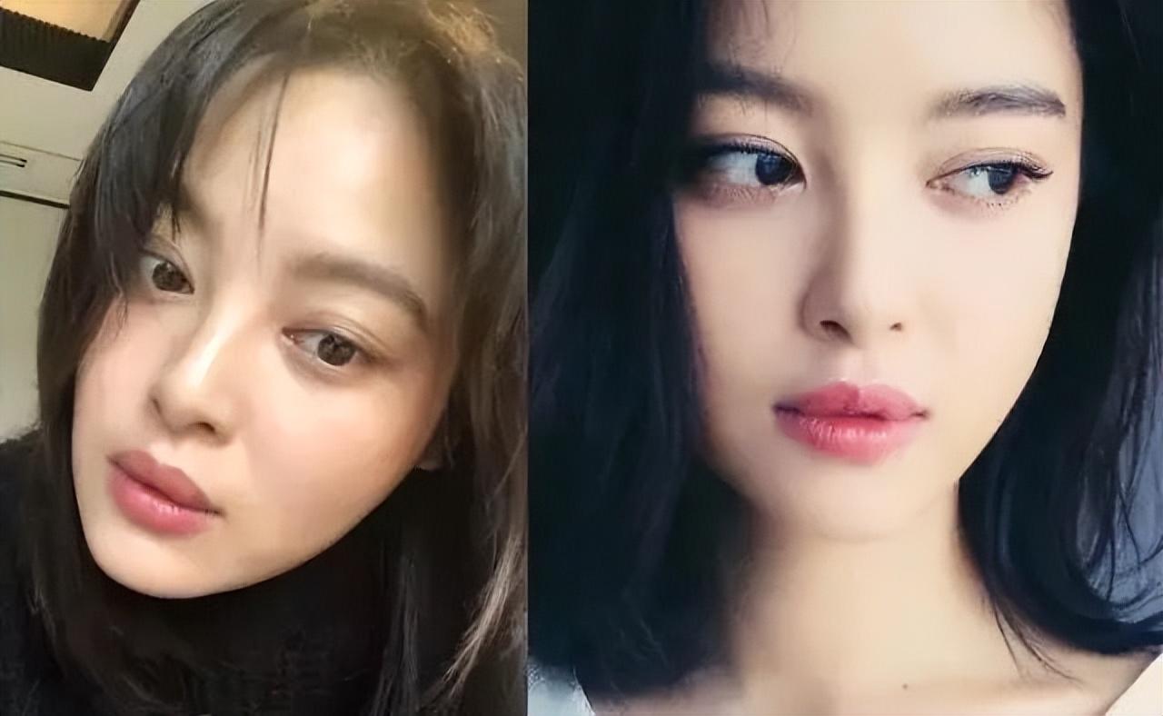 眼球凸做双眼皮更难看,比嘴突更拉垮的是"眼凸" - 玉三网