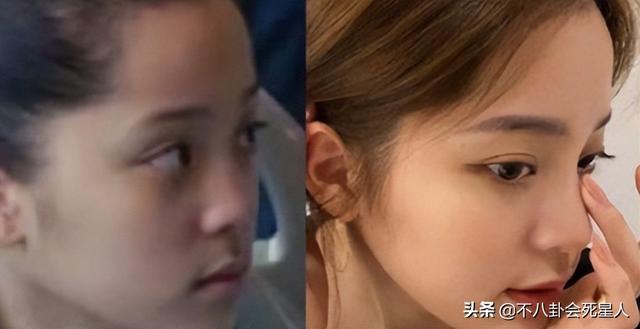 唇形分为哪几种及图片，唇形的种类（斗鸡眼、蒜头鼻、大扁嘴）