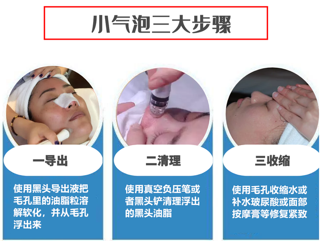 小气泡标准操作流程，美容机构的小气泡去黑头效果好吗