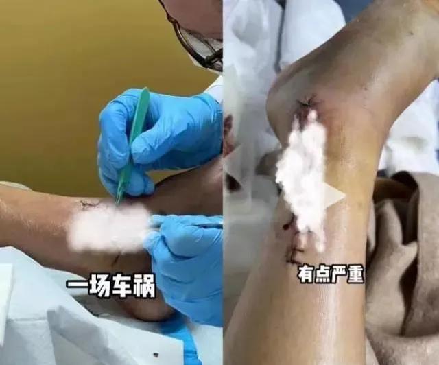 郭敬明陈学冬恋情，郭敬明为什么喜欢陈学冬（33岁陈学冬遭遇严重车祸）