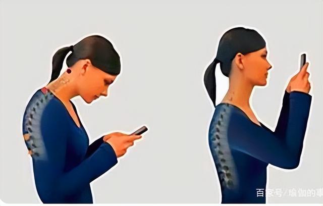 颈椎侧弯怎么矫正，颈椎病生理弯曲消失了怎么办