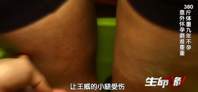 怀孕七个月胎儿图，怀孕7个月的胎儿什么样子（医生扒开脂肪层抱出7斤重的男婴）