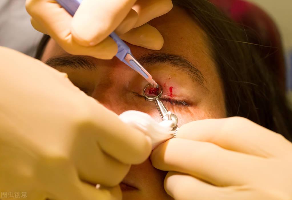 麦粒肿注意和霰粒肿区分这两者由于症状有些类似,很容易被误认,不过