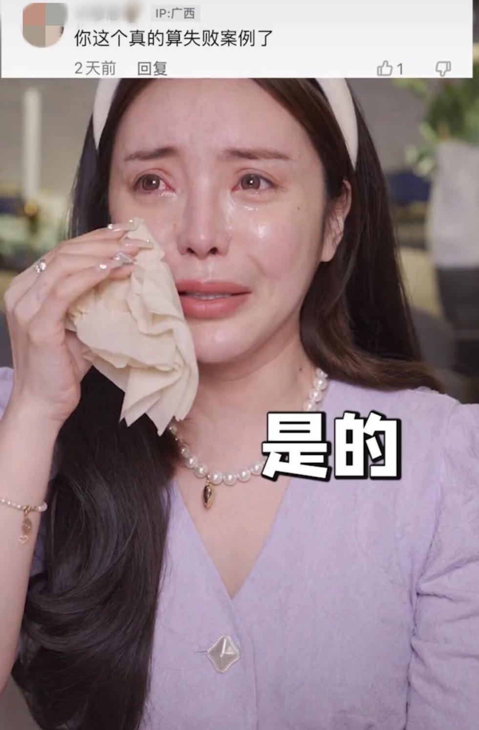 整容失败的案例（10位天生丽质却沉迷整容的网红）