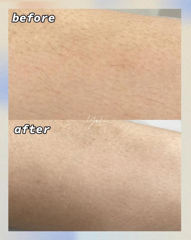 薇婷脱毛膏正确使用方法，薇婷脱毛膏正确使用方法图解（5款爆火脱毛产品真人实测）