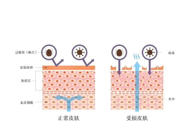 油性敏感肌膚如何修復,怎麼改善油性敏感肌膚(皮膚油,敏感的護理小