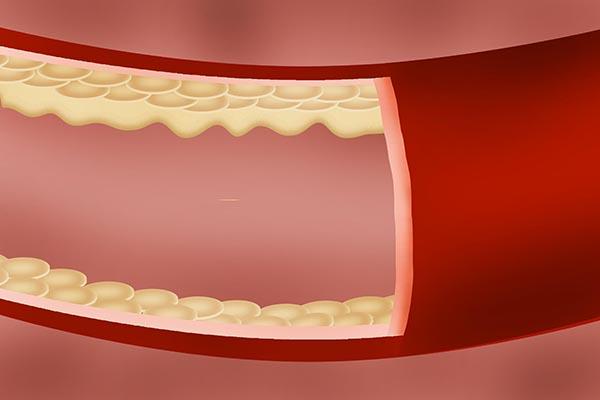 不喝酒的好处有哪些，不喝酒有啥好处（适量饮酒能延长寿命）