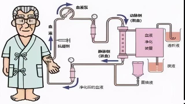 控制透析并发症的发生,这一点对于延长生命来说至关重要