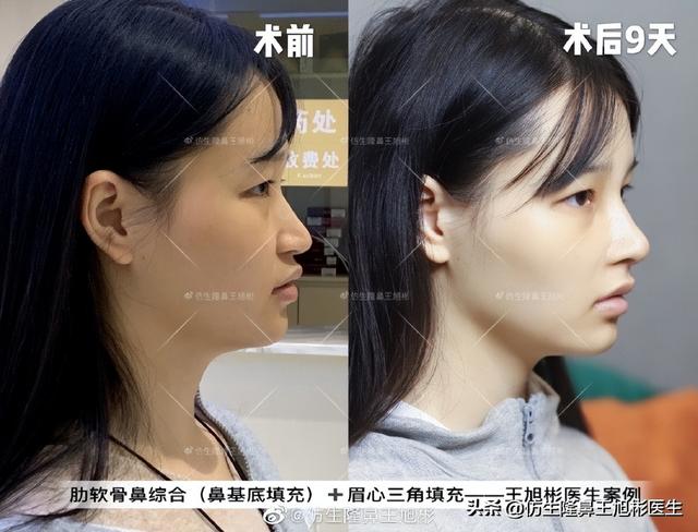 高级脸是什么意思，6种脸型不显老（“月亮脸”逆袭“高级脸”的不二法则是）