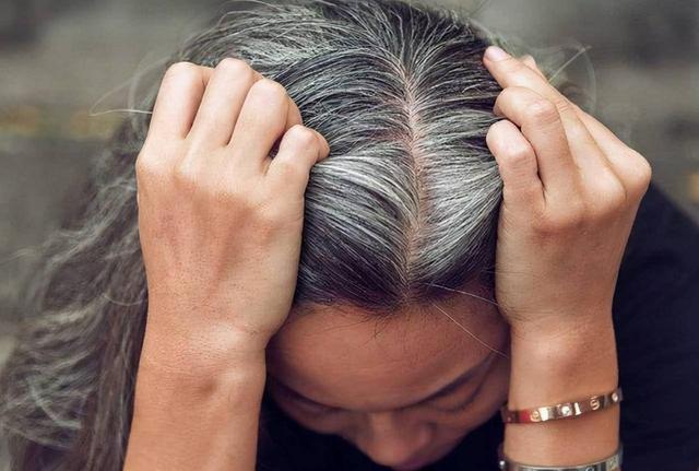 头发染太黑怎么办，头发染了太黑怎么办（女子阳性后一夜白头还脱发）
