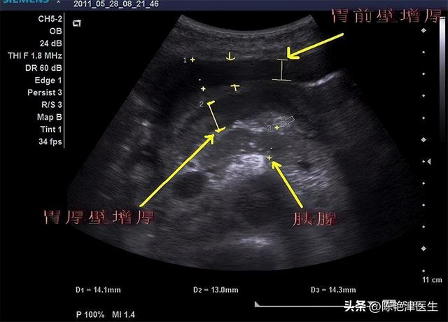 研究生入学体检，研究生入学体检是什么（医生：50岁以后做体检）