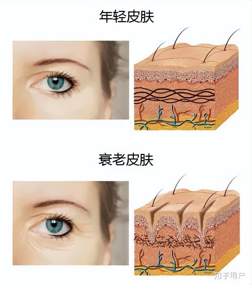 眼霜的作用大不大，眼霜用了到底有没有效果