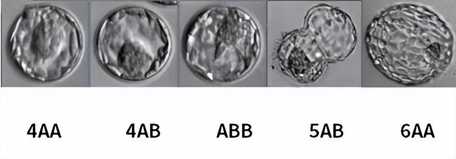 囊胚分几个等级，养囊胚有几个等级（囊胚4bb、4ab、4cb是什么级别）