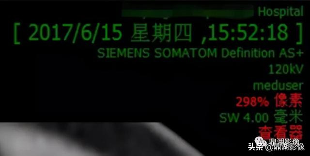 r和l哪个是左哪个是右，袜子r和l哪个是左哪个是右（竟然包含了这么多的信息）