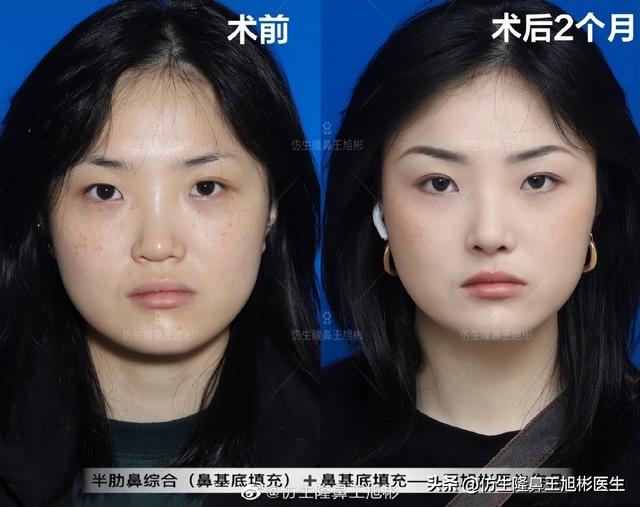 高级脸是什么意思，6种脸型不显老（“月亮脸”逆袭“高级脸”的不二法则是）