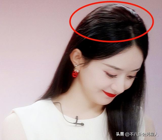 杨幂的发际线是什么样的，14位明星增发妙招
