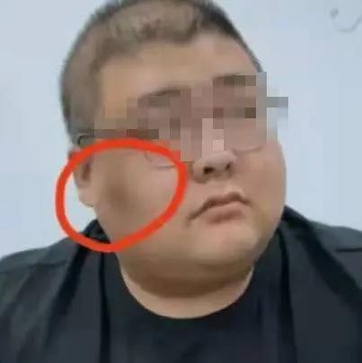 皮毒的症状图片，这6种果皮吃了会中毒（胖子脸颊或者脖子出现黑斑）