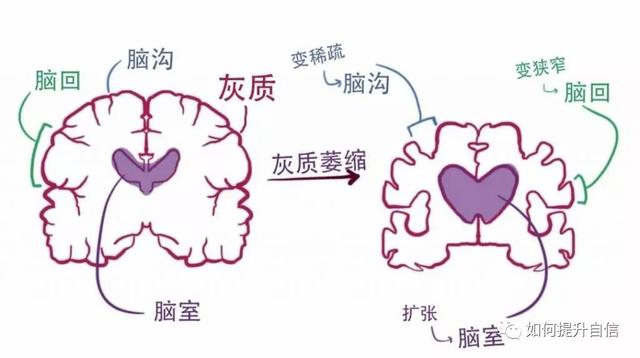 没脑子和单纯区别，没脑子和单纯区别是什么（花10分钟认识你的大脑）