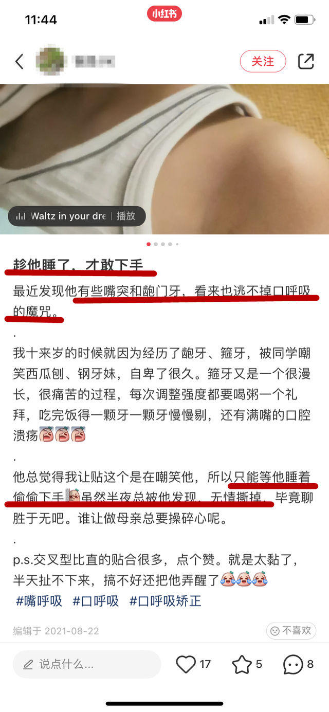 口呼吸嘴凸怎么矫正，口呼吸嘴凸怎么矫正视频（1亿人围观的口呼吸贴）