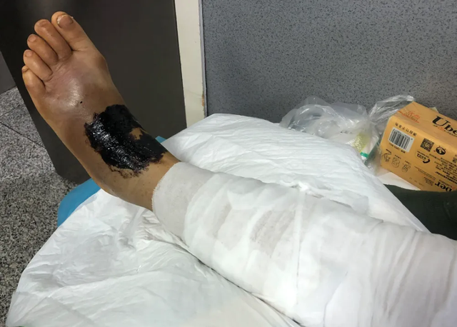 雄黄驱蛇是真的吗，驱蛇用雄黄还是硫磺（江西老人在被窝里摸到蛇）