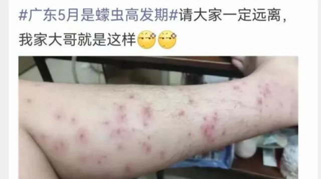 被臭虫咬了怎么办，臭虫怕什么（医生：奶奶做得好）