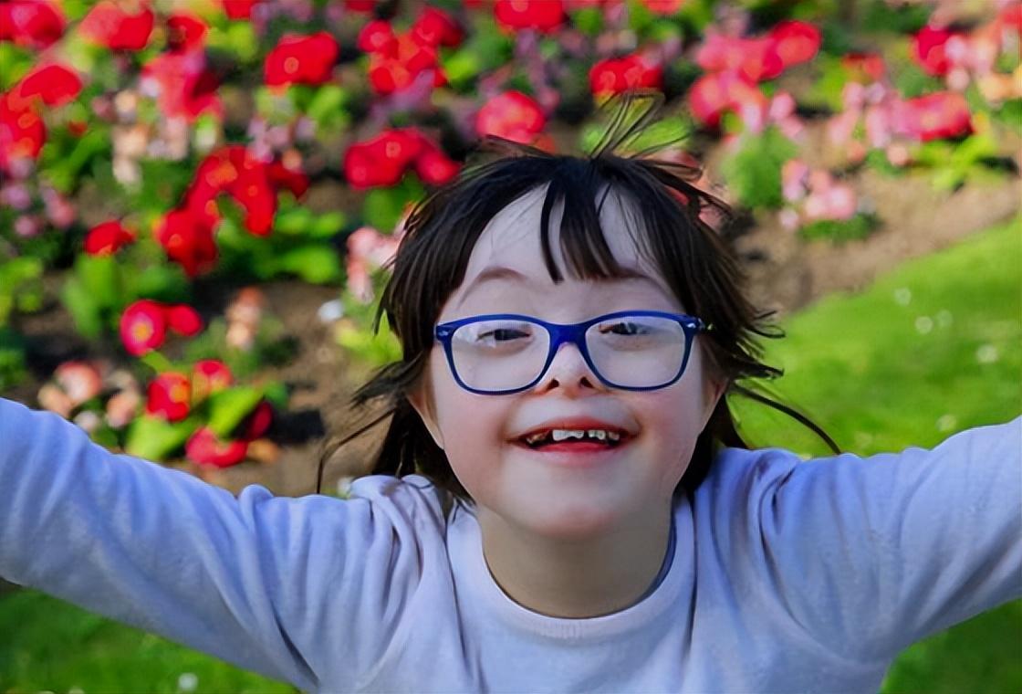 唐氏综合征(什么是唐氏综合症) - 乐宝宝贝