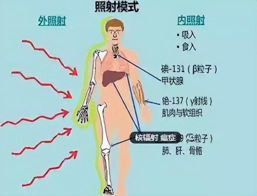 普通人如何防核辐射，怎么预防核辐射和核事故（普通人该如何自救）