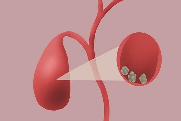 76公斤是多少斤，76公斤是多少斤体重（男性身高170-180）