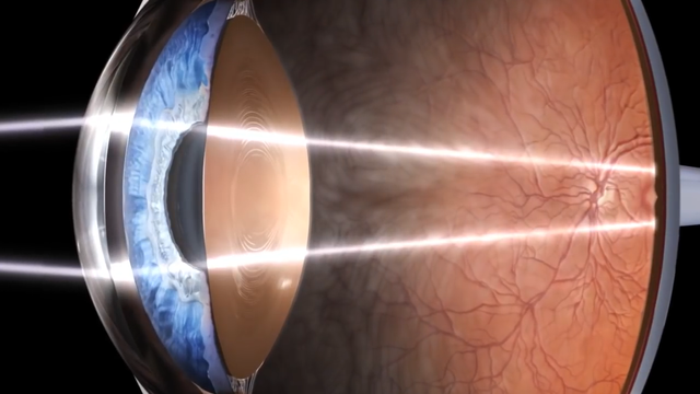 人眼是什么结构，人眼的主要结构（究竟如何进化而来的）