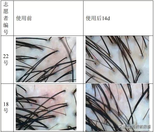 消费者报道权威检测，dpph全称