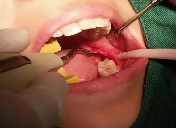 艾滋病怎么得的，男性怎么判断自己有没有性疾病（洁身自好，为什么还会得艾滋病）