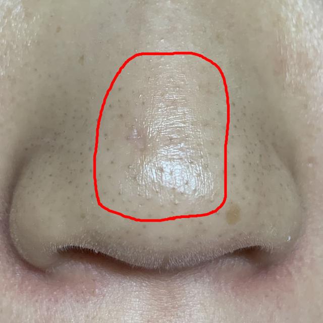 脸部能天天热敷吗，热敷脸有哪些功效与作用（面膜可以天天敷吗）