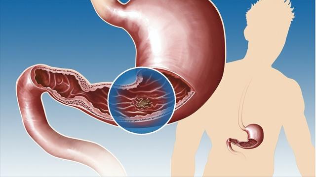 什么食物含硒多，十大含硒高的食物（硒对人体到底有多重要）