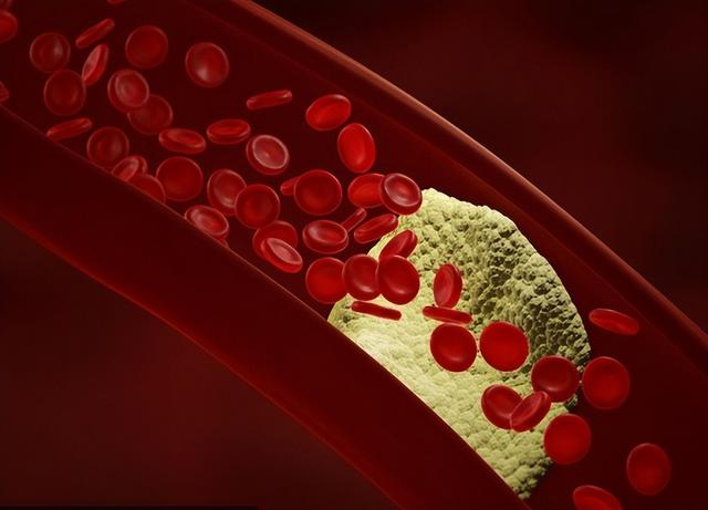 嘌呤高是什么意思，高嘌呤是什么意思（“嘌呤大户”被揪出）