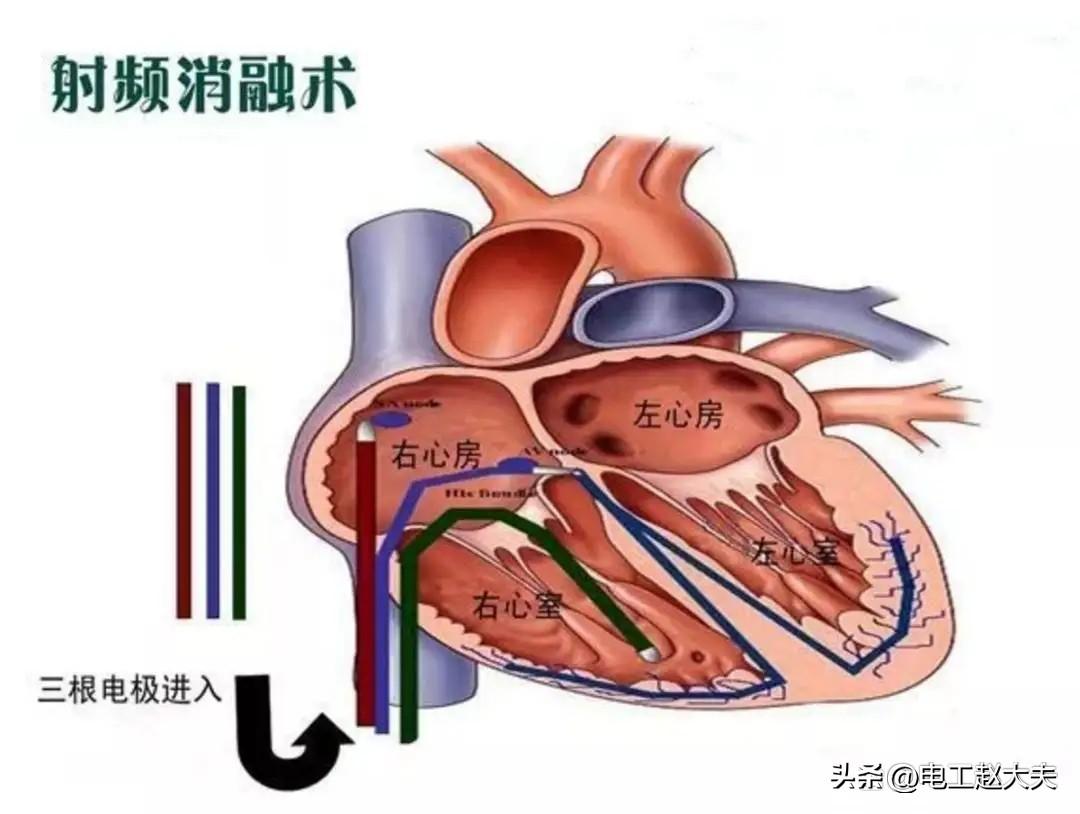 心脏隐隐作痛会猝死吗()插图(1)