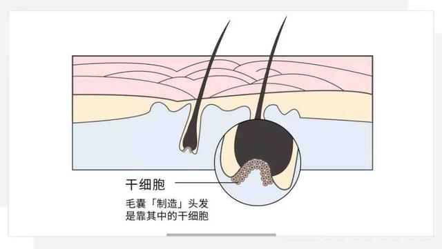 头发掉的厉害是什么原因，头发掉的特别厉害是什么原因导致的（头发掉得厉害？可能是这个原因）