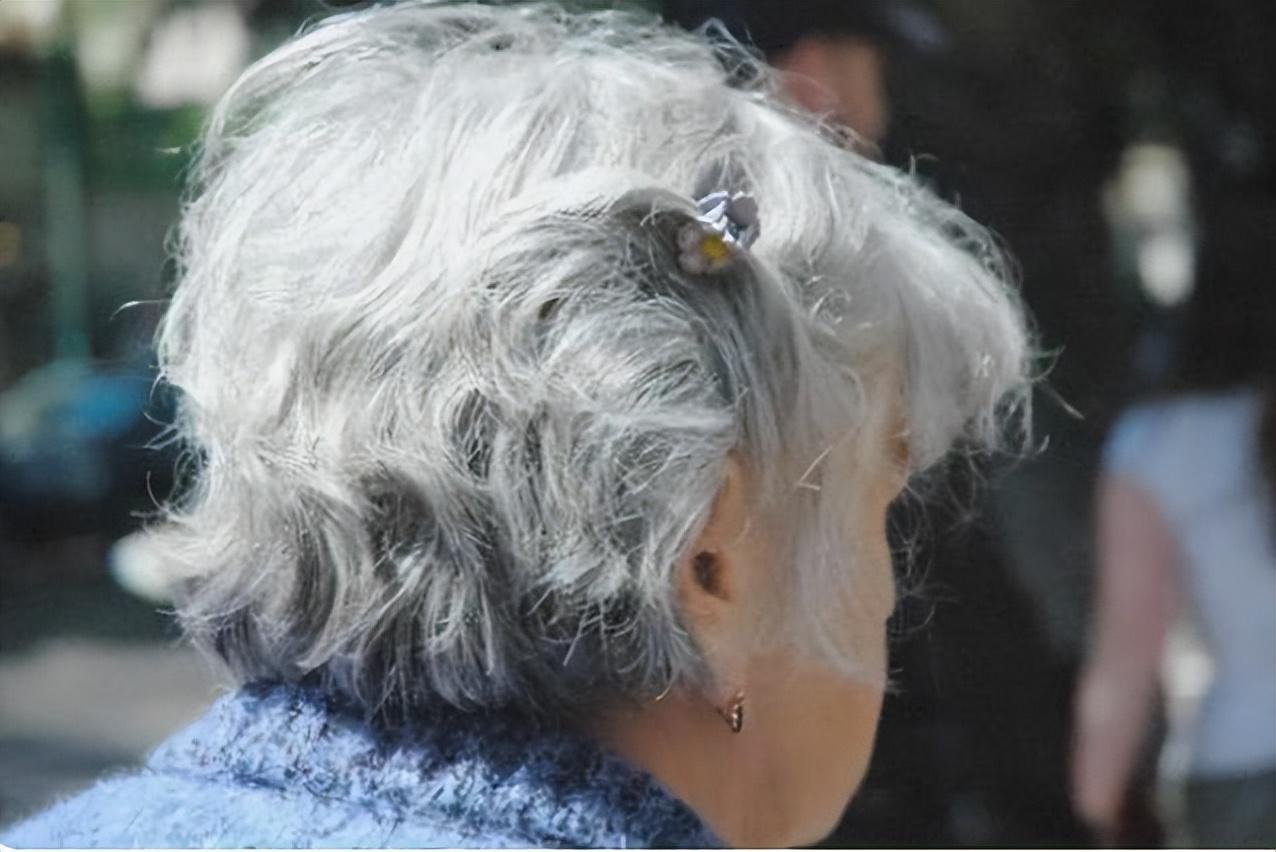 少白头是什么原因(出现白发或是因为维生素不足) - 百百科