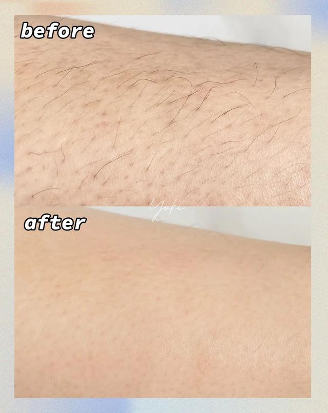 薇婷脱毛膏正确使用方法，薇婷脱毛膏正确使用方法图解（5款爆火脱毛产品真人实测）