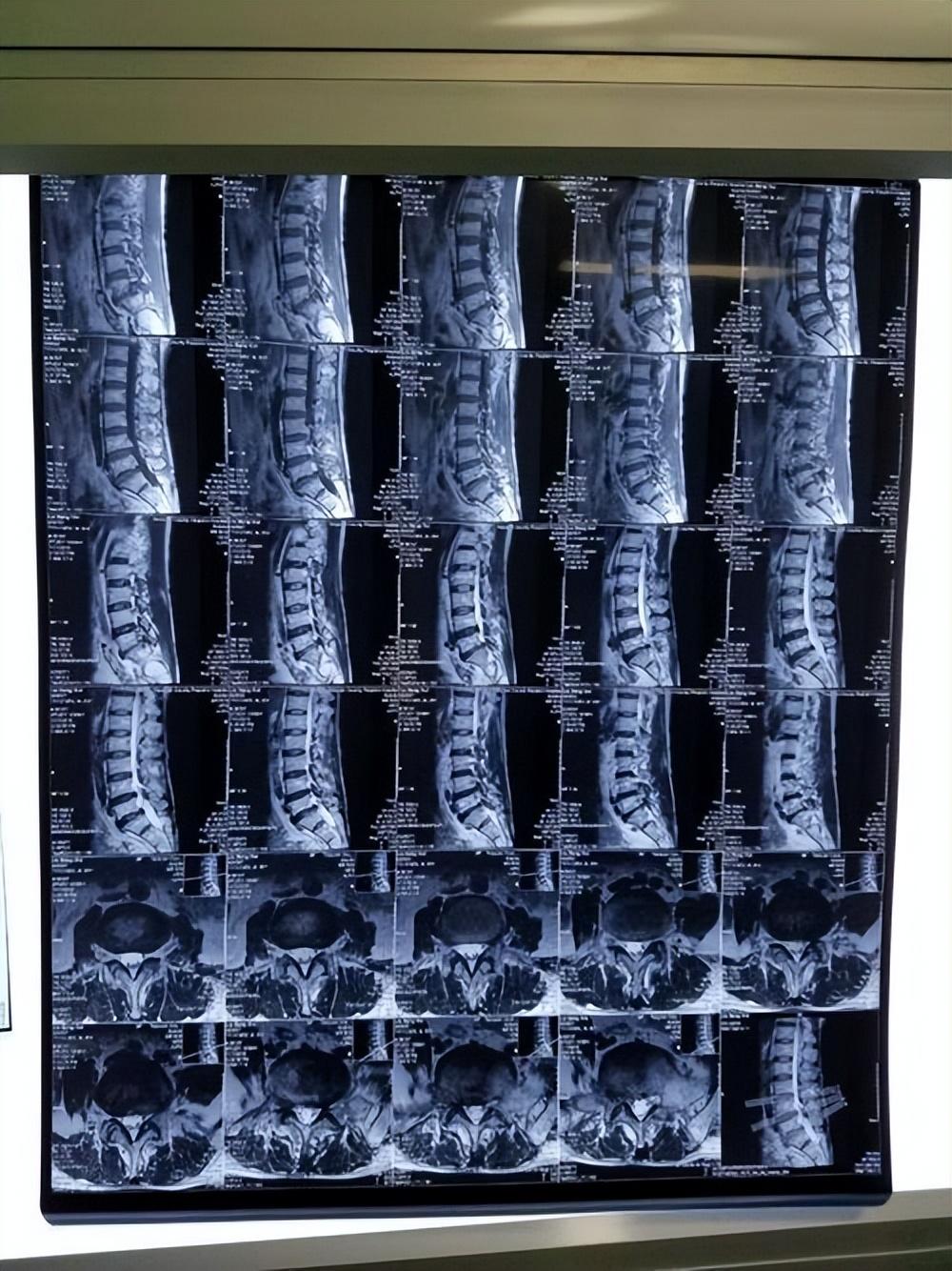 耳朵磁共振要多少钱(核磁共振) - 价格百科