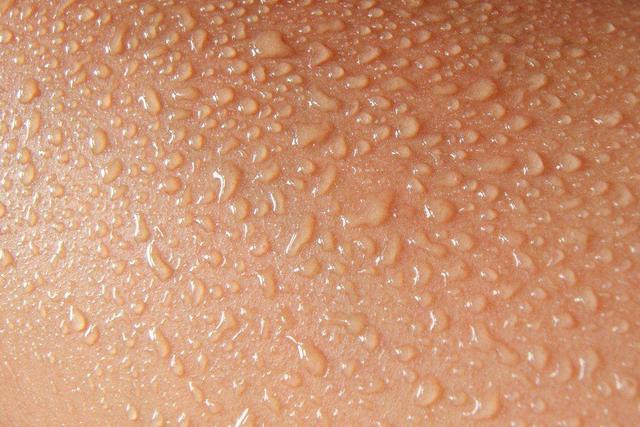 睡觉老是出汗，吃饭也是出汗，这是什么原因，睡觉老是出汗（经常出头汗是什么原因）